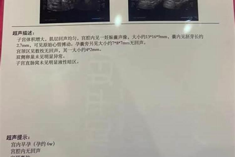 婴灵真的存在吗