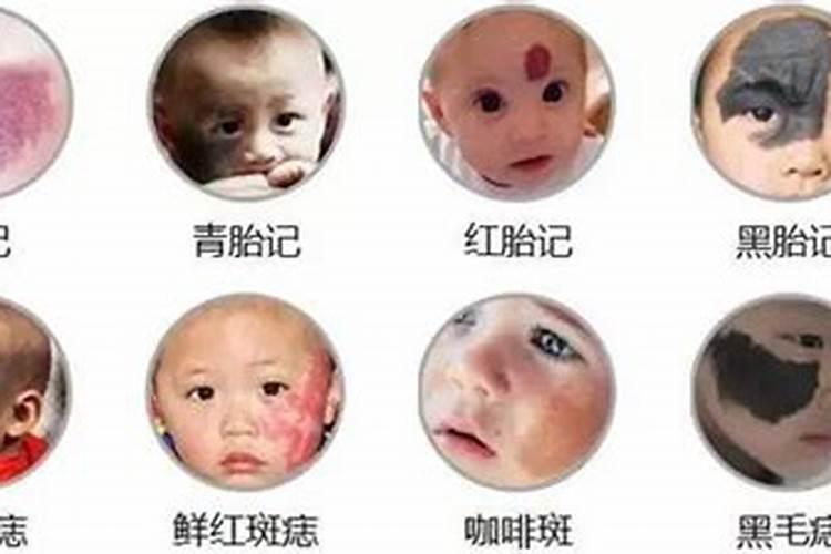 童子下凡有什么胎记