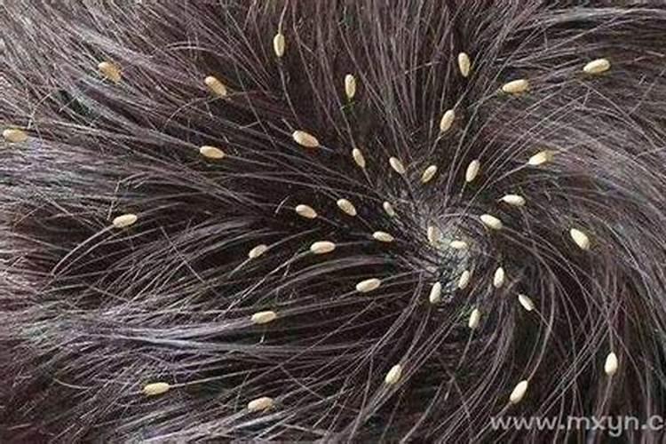 梦到头上长虱子什么意思