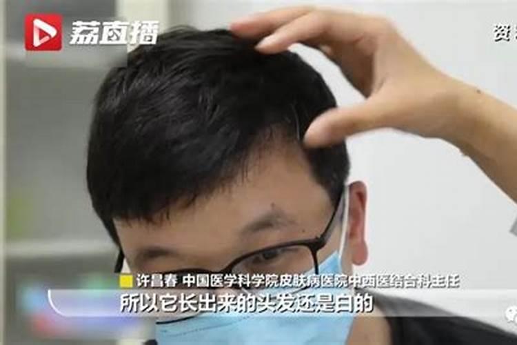 美人尖剃了影响运势吗,美人尖刮掉会怎样