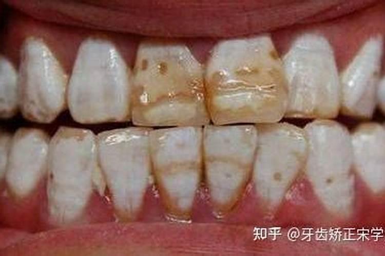 春节期间的中国传统风俗有哪些呀？谢谢!