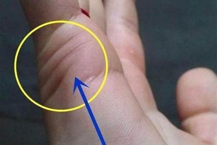 女人有两条婚姻线代表什么 一长一短婚姻不顺？