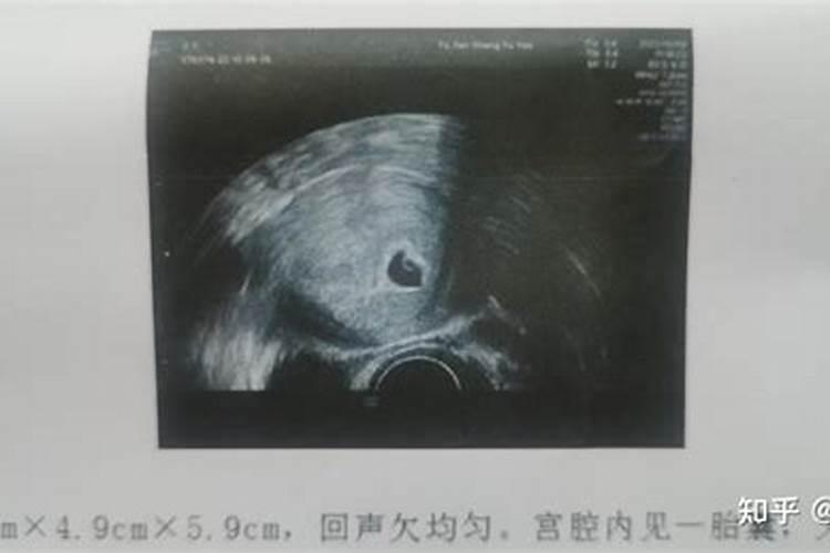 打胎掉的孩子会回来报复吗,我打胎了,现在很后悔,怎么办