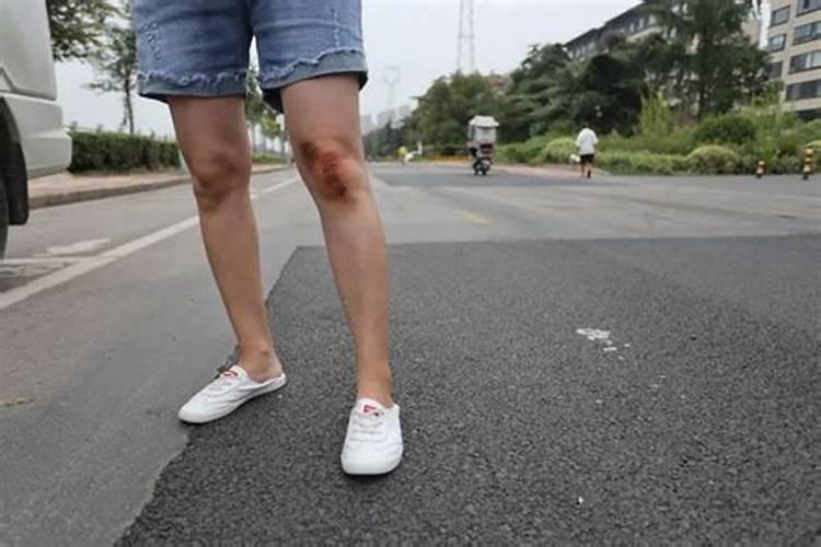 梦见骑车摔倒受伤的预兆