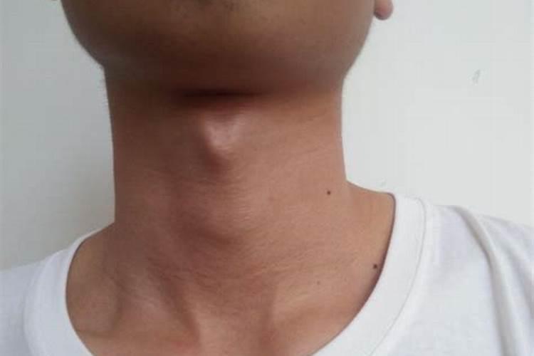 喉结过大的男人运势会怎样