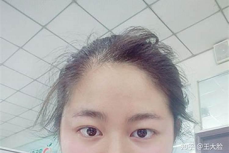 发际线太低会影响我们运势吗