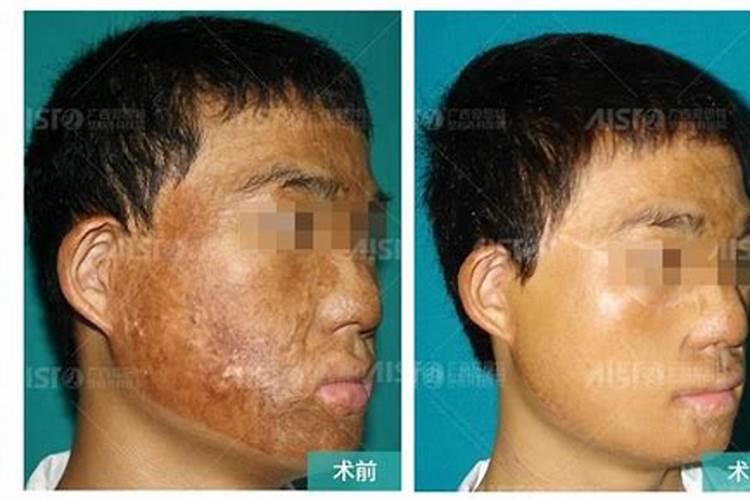 关于面相学里对整容的看法