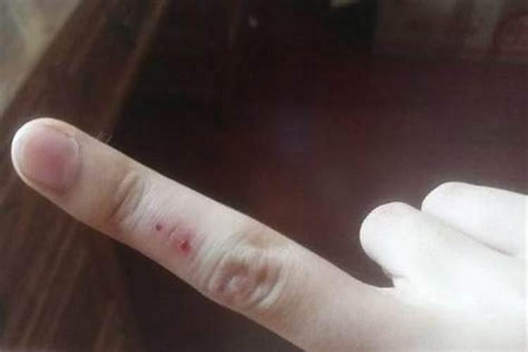 梦见手上划了个大口子流血的预兆