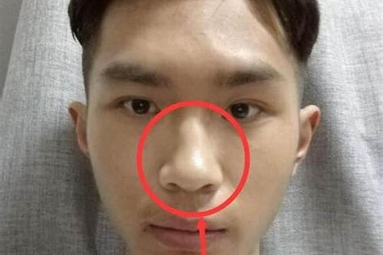 鼻孔大的男人命好吗