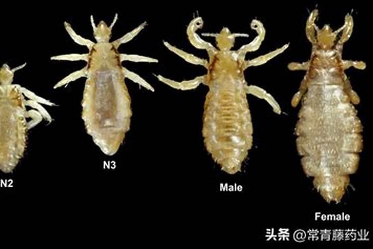 女人梦见自己头上长虱子是怎么回事？
