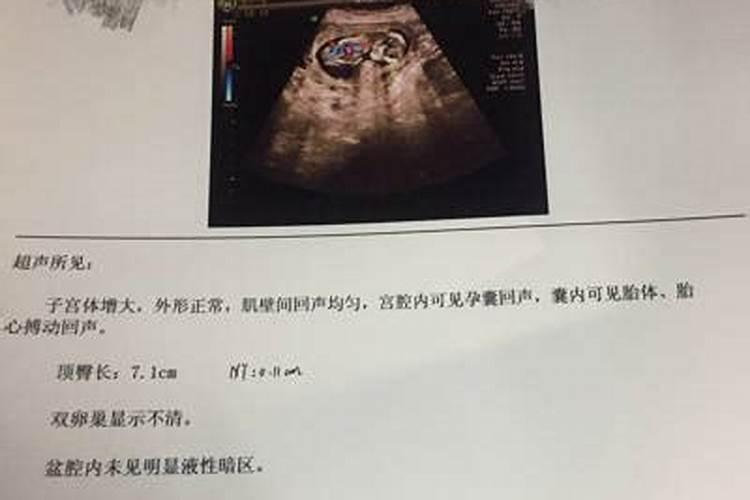 打胎后需要超度吗
