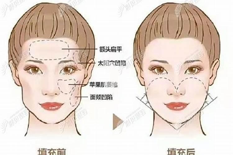 梦见家人又结婚的预兆