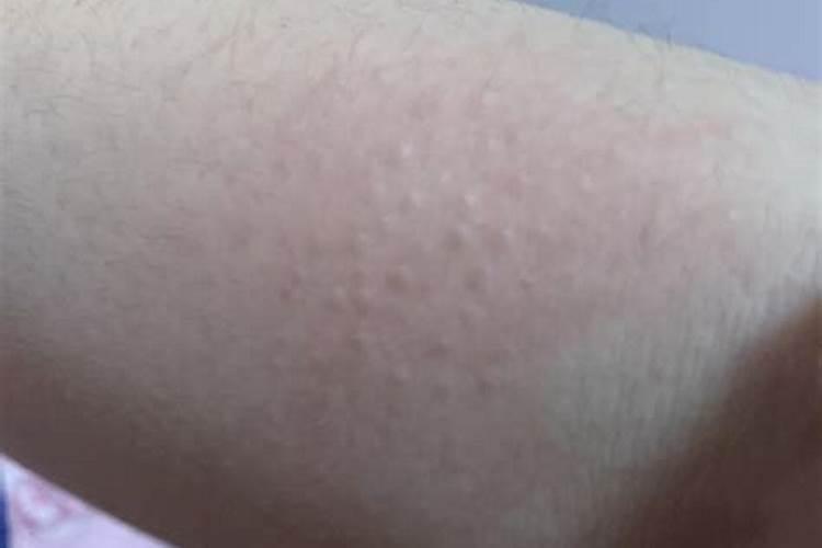 梦见身上长出小手的预兆