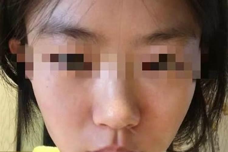 梦见自己脸晒黑的预兆