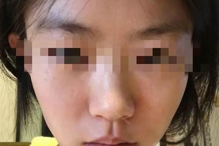 梦见脸晒黑了