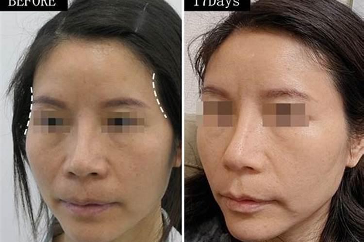 传说夫妻宫凹陷的女人婚姻不好吗,夫妻宫凹陷怎么办？