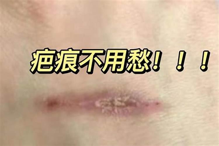 梦见老婆的脸上有伤的预兆