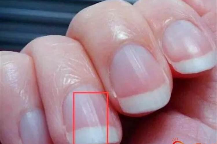 脚上有这几个特点的女人,丈夫财源滚滚