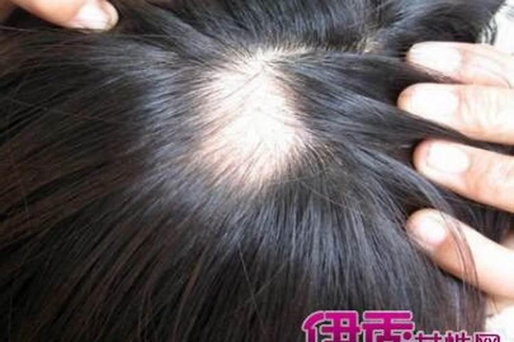 女人梦见头发下半截断了