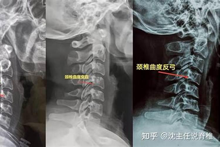 骨相好的人有哪些特点？一生的运势又如何