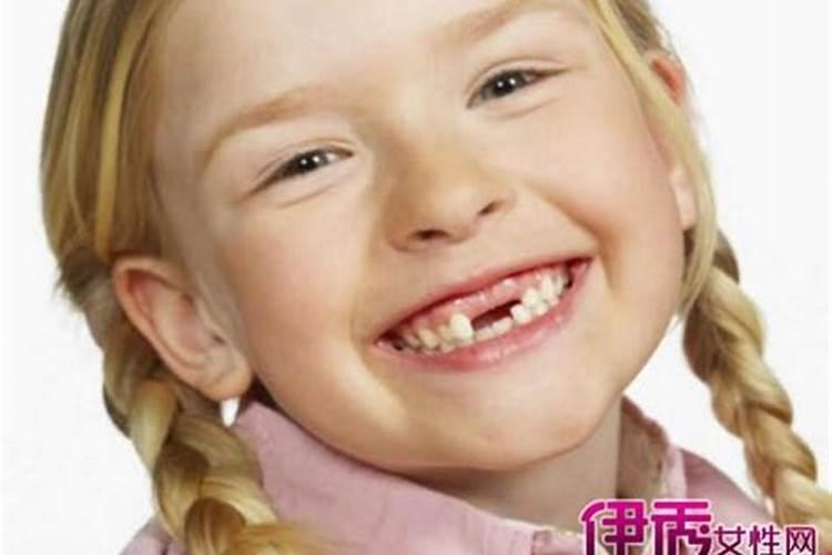 梦见自己掉牙齿什么意思