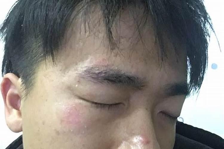 除夕流血预示什么