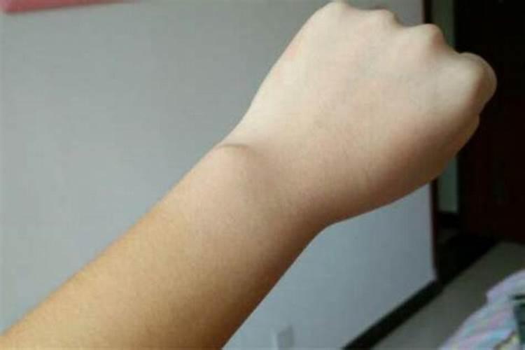 问:梦见自己的胳膊因为什么原因被切断然后又接上去,只不过少了一节胳 ...