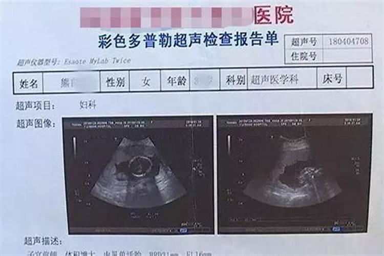 打胎真的会有报应吗