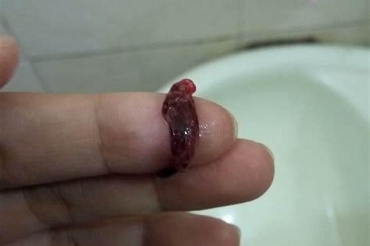 流产流出来的东西是什么样的