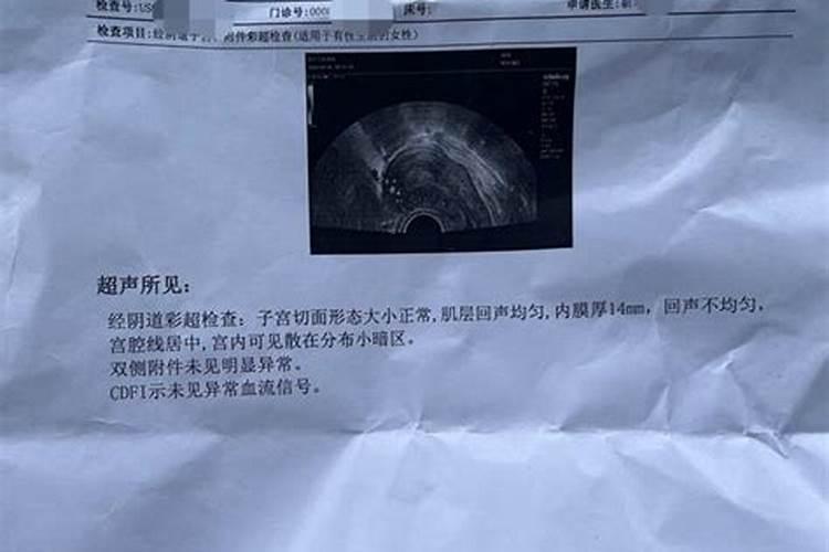 佛教里说堕胎婴灵很苦保胎没保住,算堕胎吗？