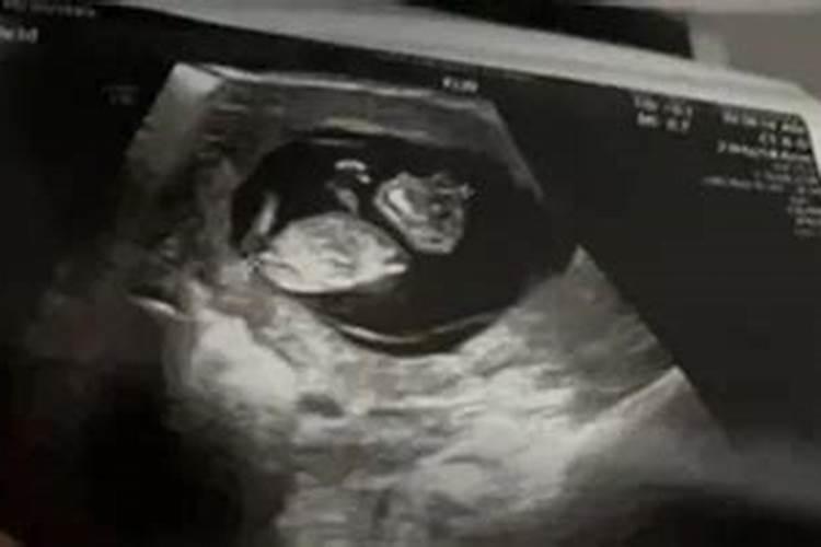 婴儿死了灵魂会长大吗  百度宝宝知道