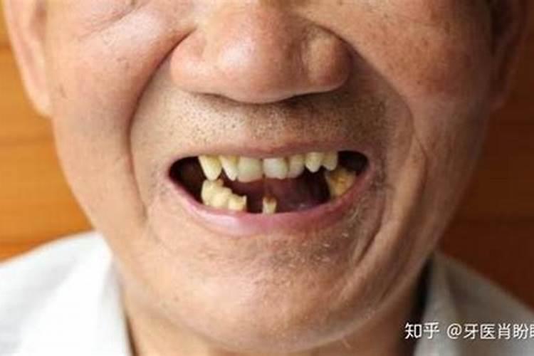 李一的人物经历