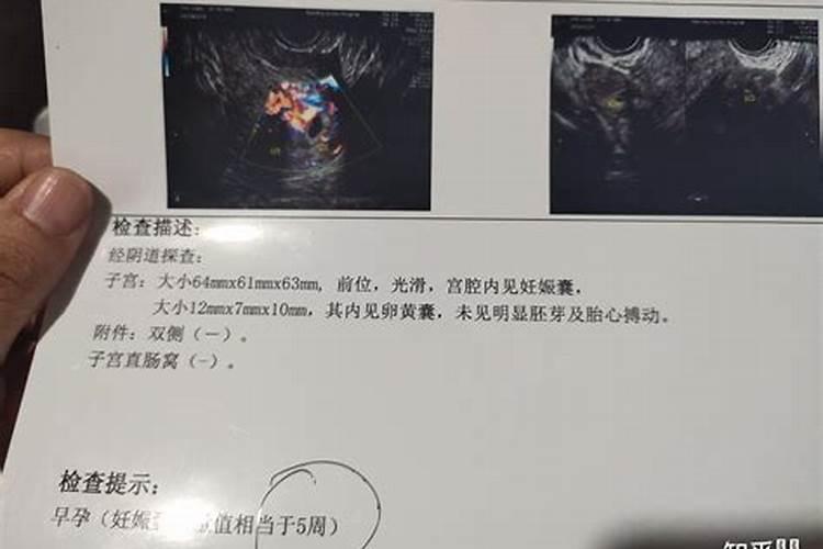 给亡人念七天四十天百天是效仿汗俗吗