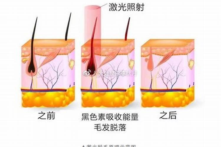 痣上长毛好不好 黑痣上长毛能剪吗
