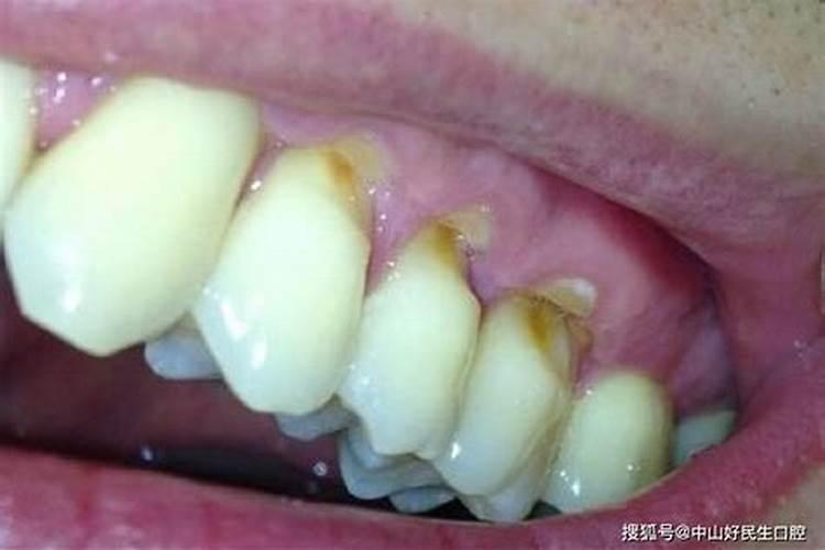 阜新市民政局关于清明节扫墓的规定