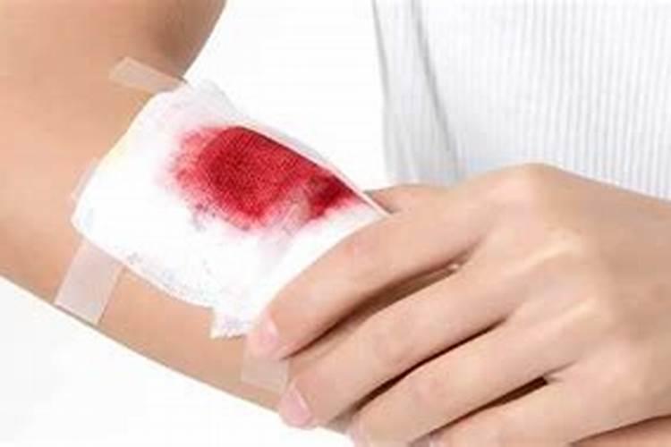 孕妇梦见手上伤口很深不见血