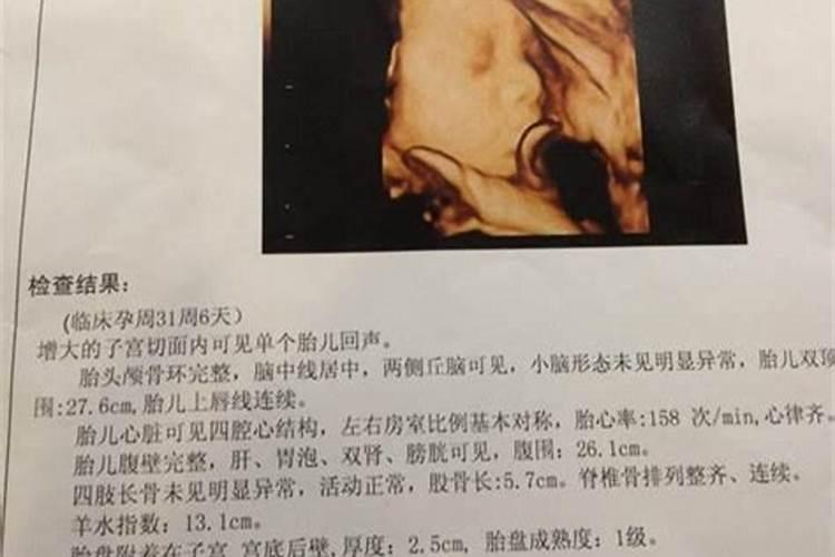 女人堕胎能不能去拜佛