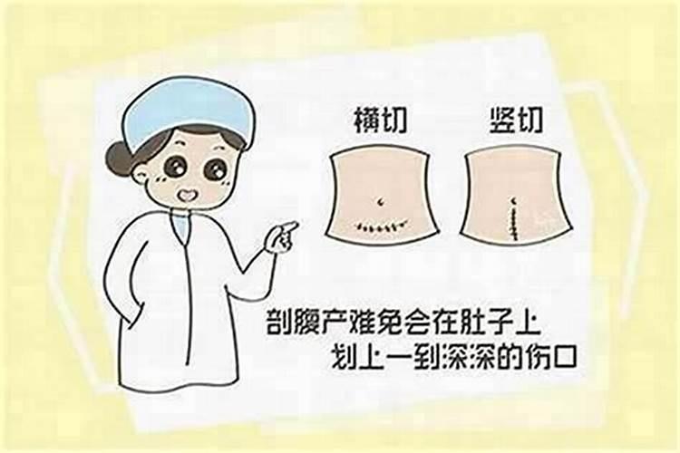 剖腹产的生辰准吗