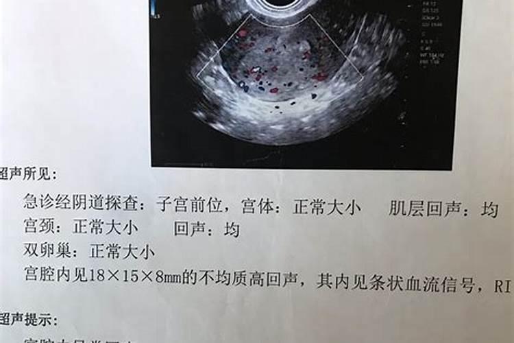 绿萝长的太长了怎么办