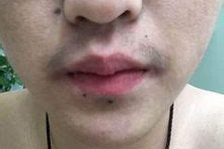 极少见大富大贵痣 吃喝不愁手心痣？