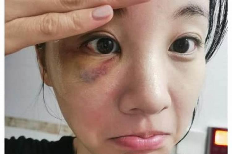遇上小人破财了怎么办