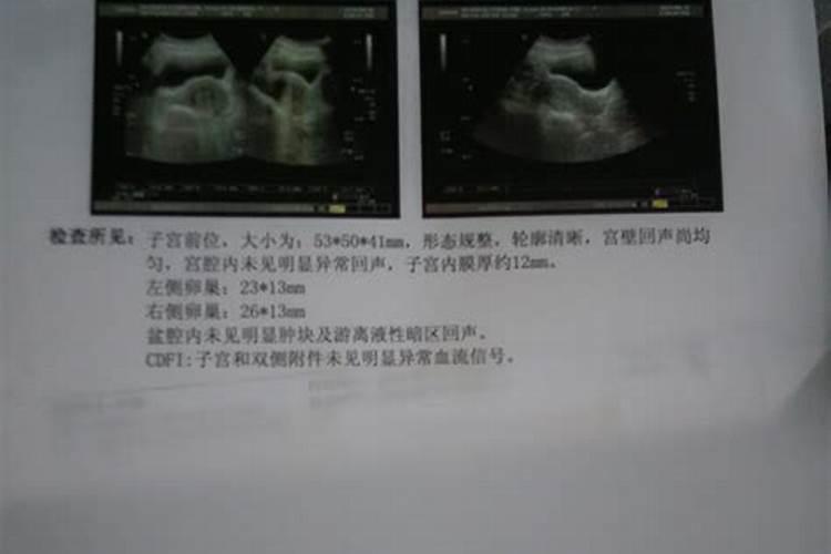堕胎会影响运势么