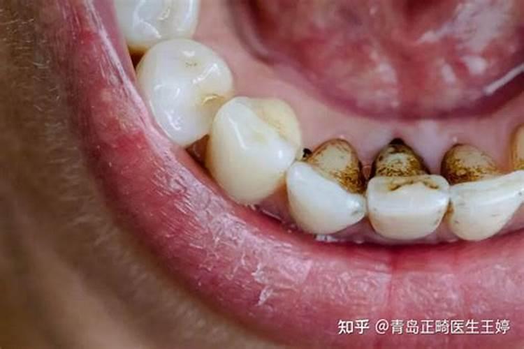 剪彩用的大红花是怎么做的啊