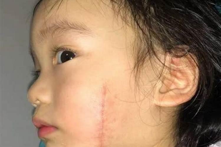怀孕多久打掉小孩合适