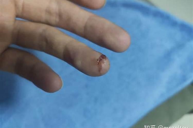 梦到手被割破一个大口子预示什么 不同的人梦到手被割破一个大口子的梦 ...