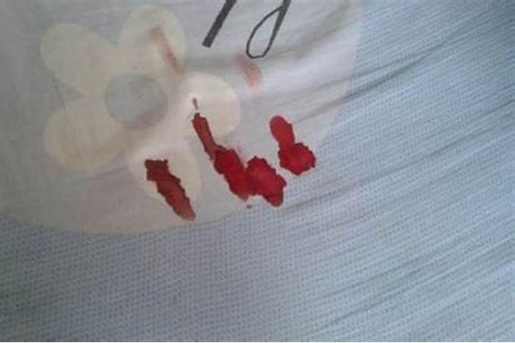 梦见被狗咬身体各部位是什么意思？做梦梦见被狗咬身体各部位好不好百度...