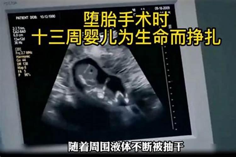 堕胎有没有报应