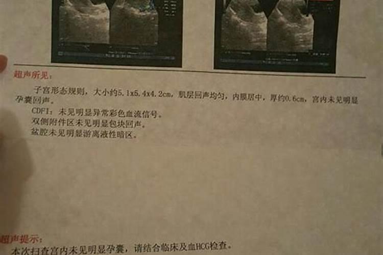 流产下来的孕囊能埋吗 怎么辨别流产的是孕囊