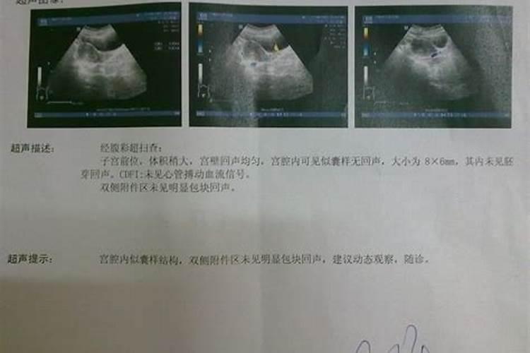 打胎后需要超度吗