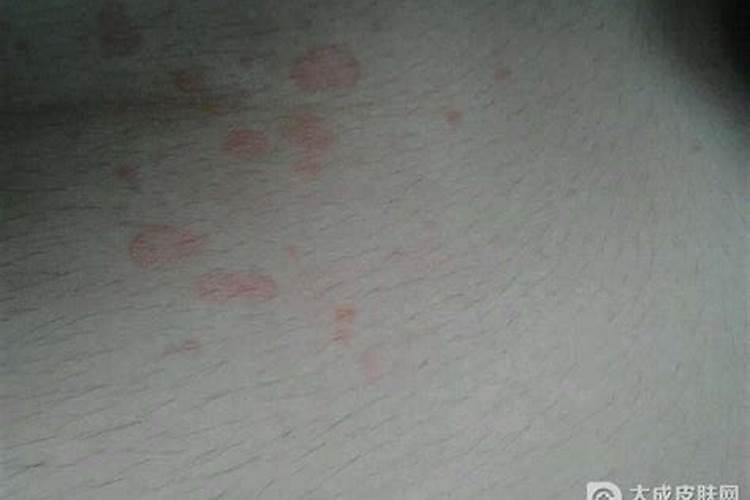 梦见妻子脸上长红斑的预兆